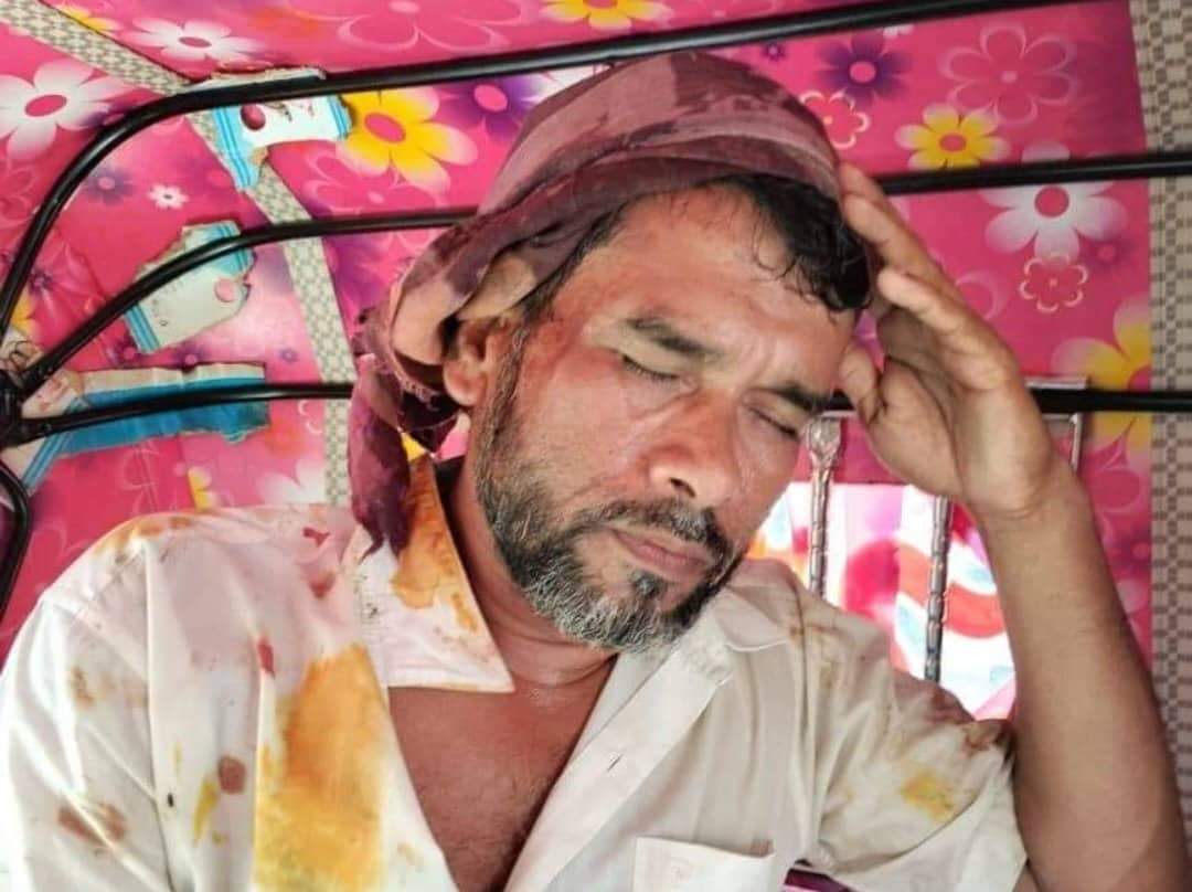 কমলনগরে ইউপি সদস্যের ওপর হামলার ঘটনায় মামলা।