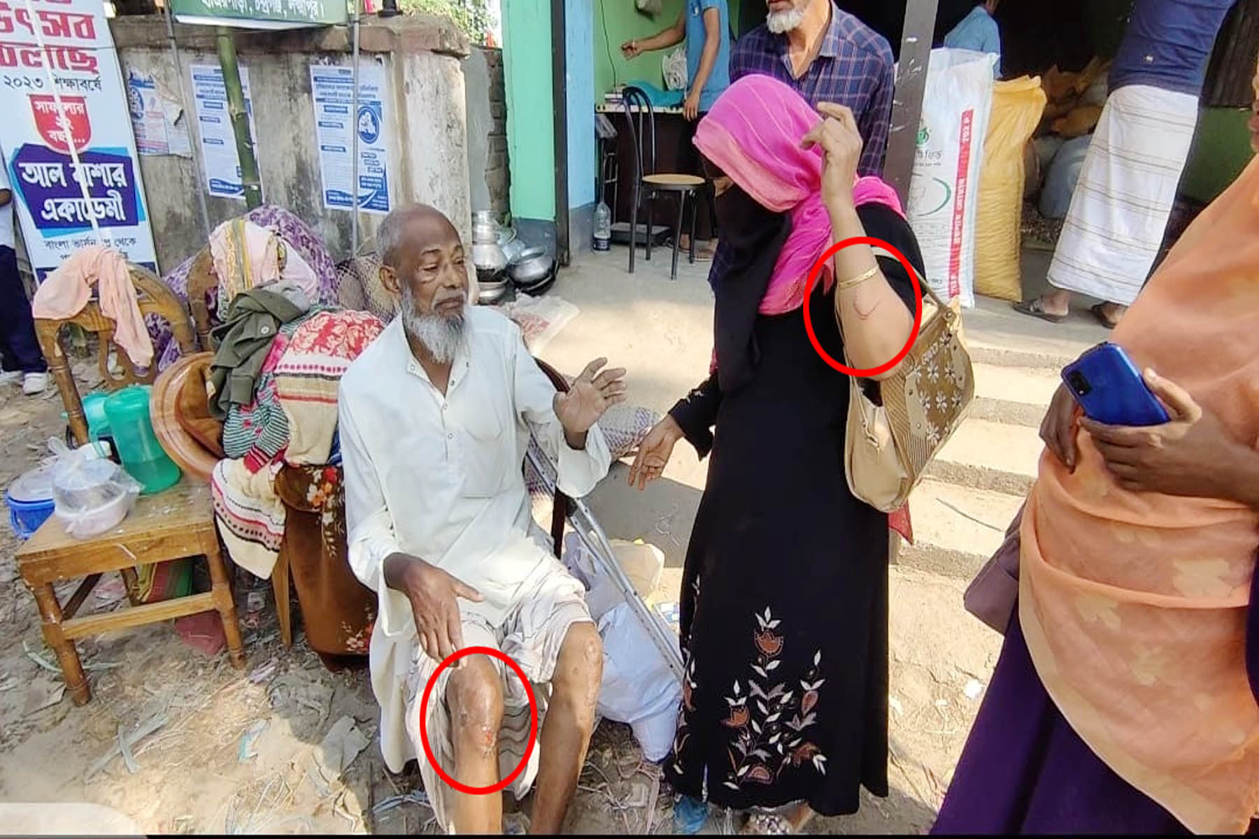 লক্ষ্মীপুরে জামায়াত নেতা অধ্যক্ষের নেতৃত্বে প্রতিবন্ধীকে মারধর ও বসত থেকে উচ্ছেদ