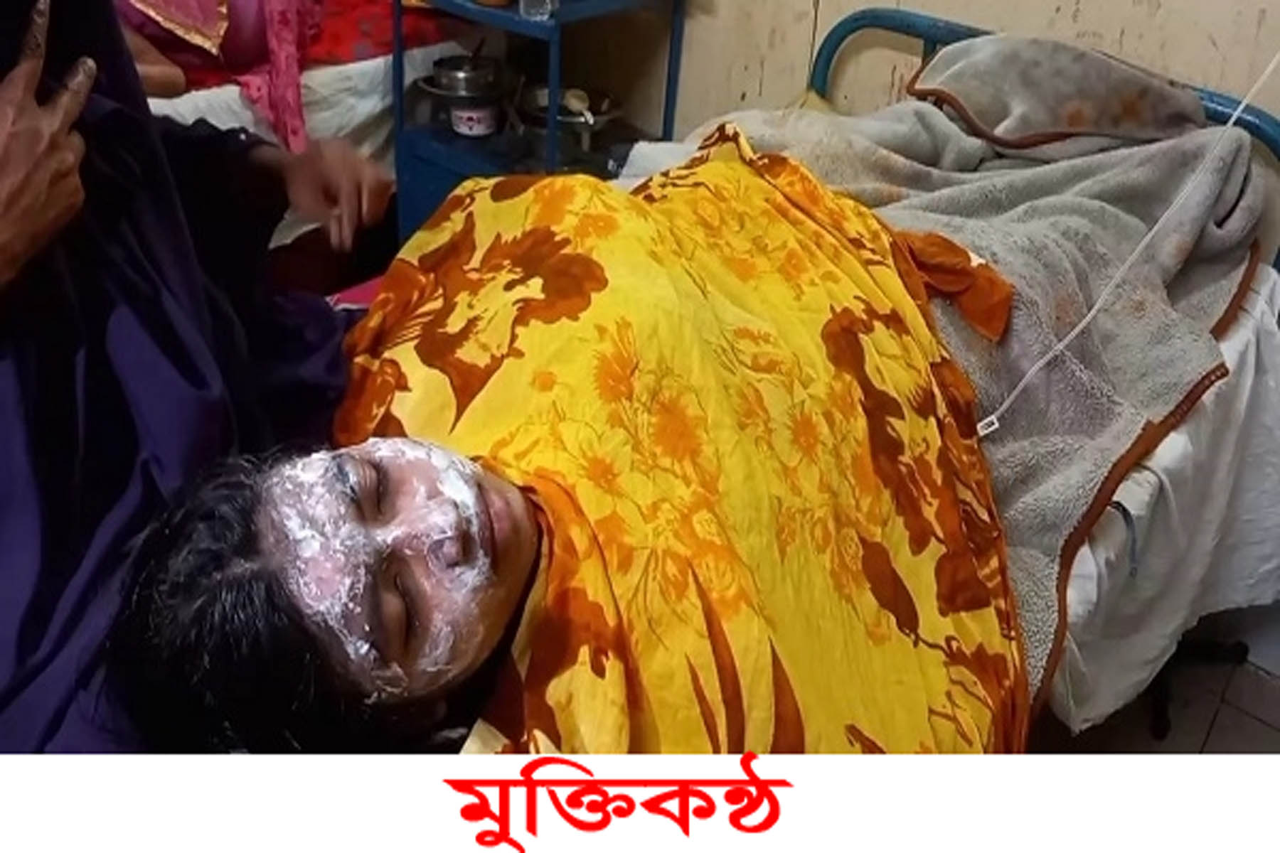 লক্ষ্মীপুরে কলেজ ছাত্রীর গায়ে গরম চা ঢেলে ঝলসে দিলেন মামী
